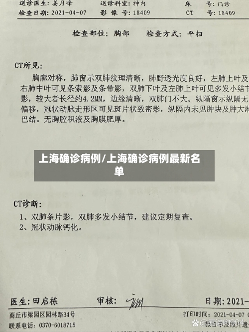 上海确诊病例/上海确诊病例最新名单